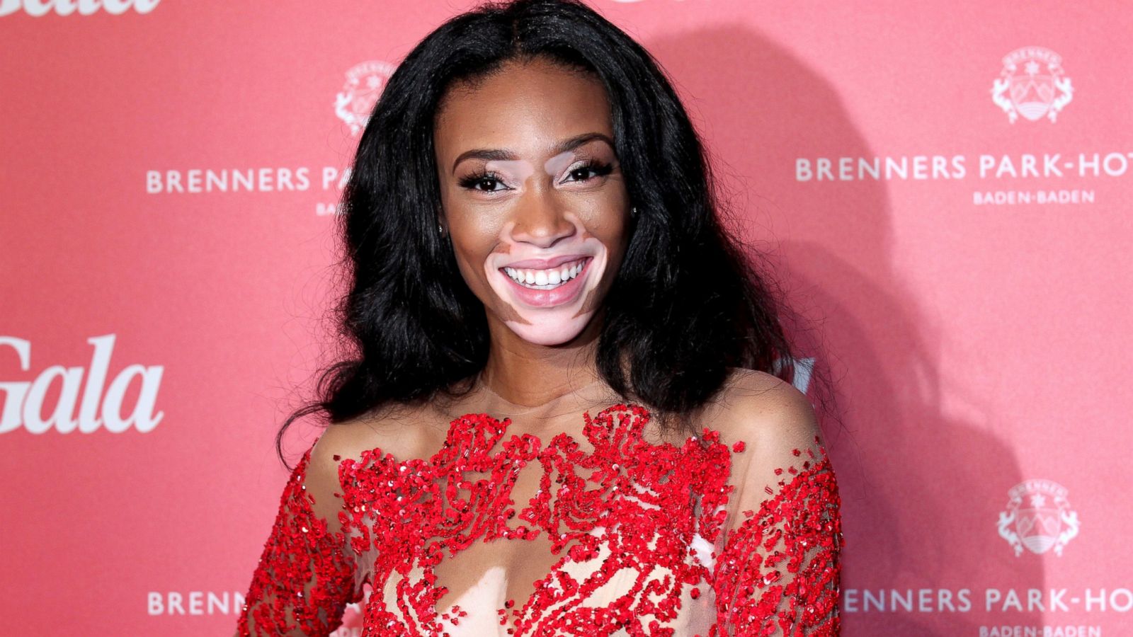 Winnie Harlow Wallpapers