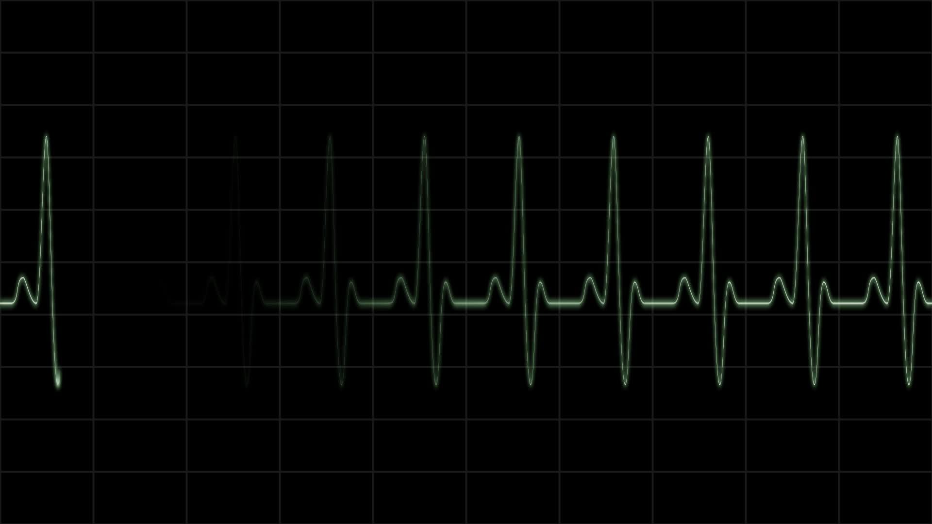 Ekg Wallpapers